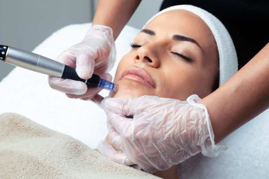 bellair laser clinic treatment toronto