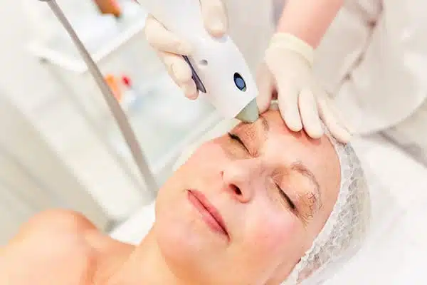 3D Face (Titan, Laser Genesis & IPL)