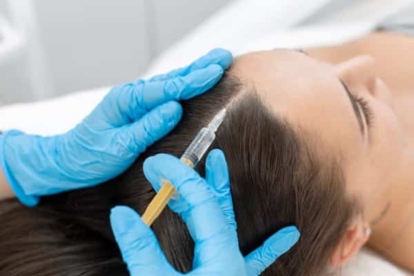 Carboxytherapy Scalp