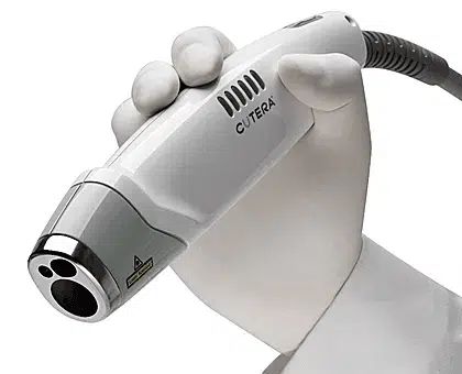 laser genesis handpiece