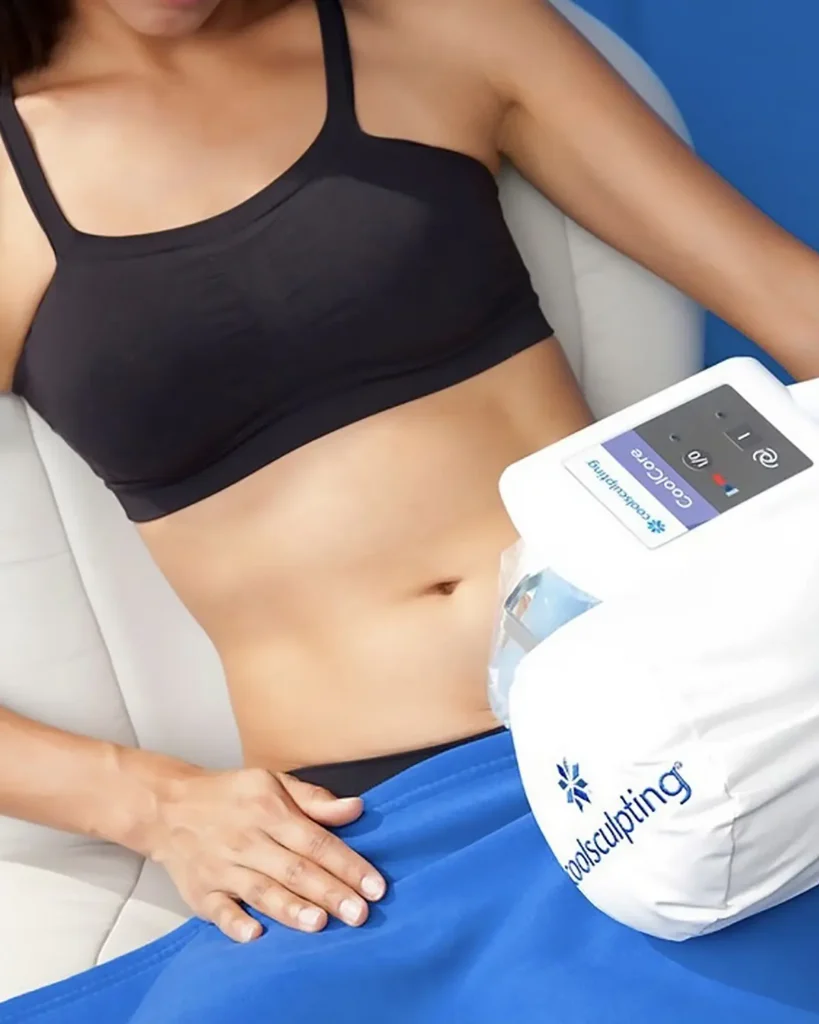 After Coolsculpting Area Image