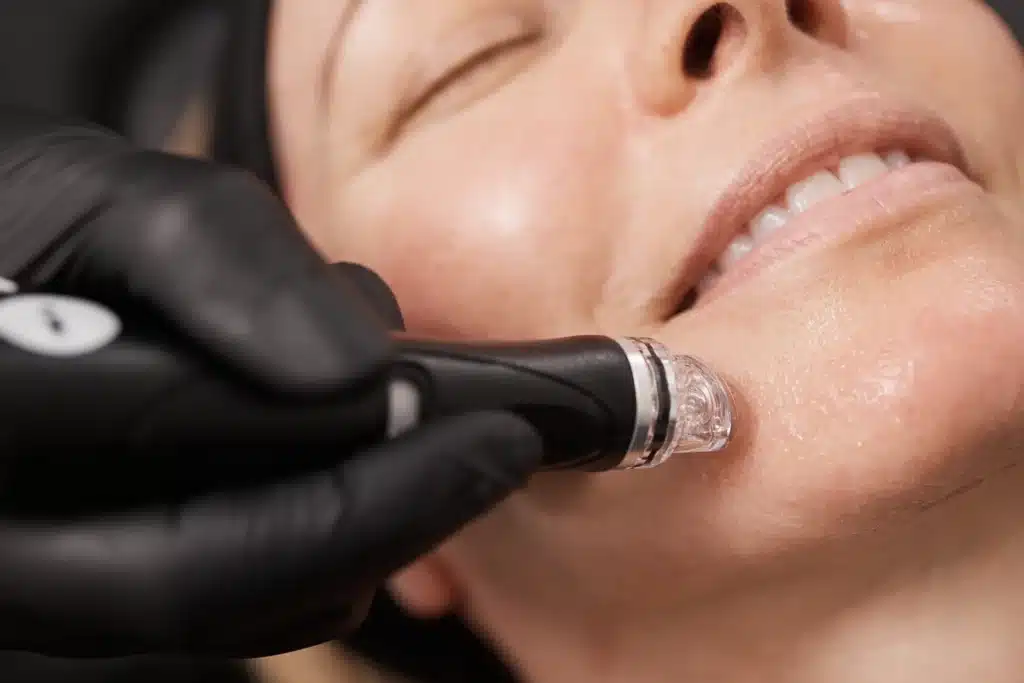 Signature Hydrafacial