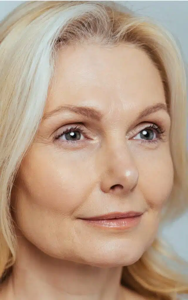 2D Face & Neck (Laser Genesis & IPL)