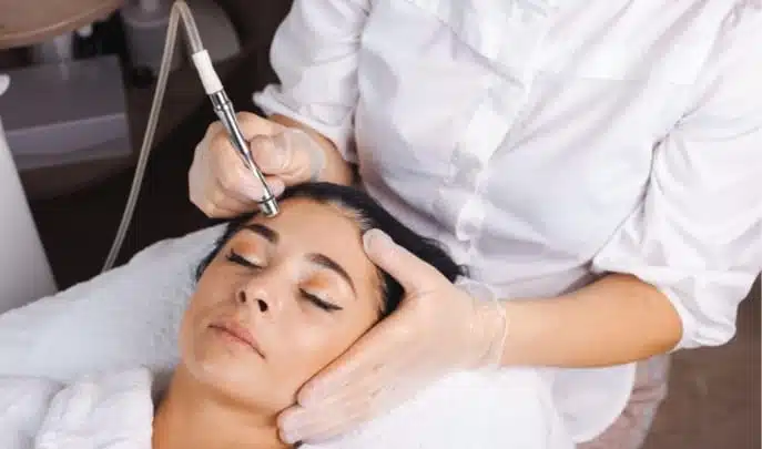 Skin Tag Removal Large