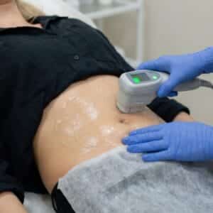 HIFU Abdomen