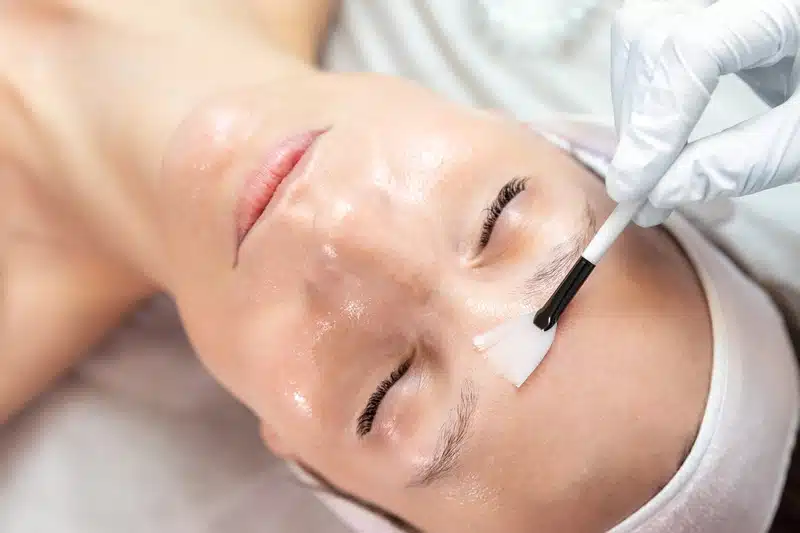 Chemical Peels vs Laser Resurfacing: Which Fits Your Skin?