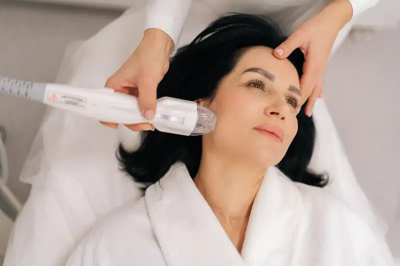 Choosing a Microneedling Clinic in Toronto: What Matters