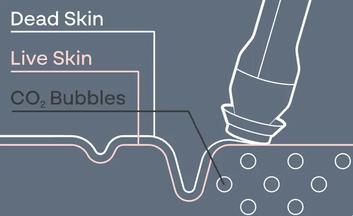 Exfoliation