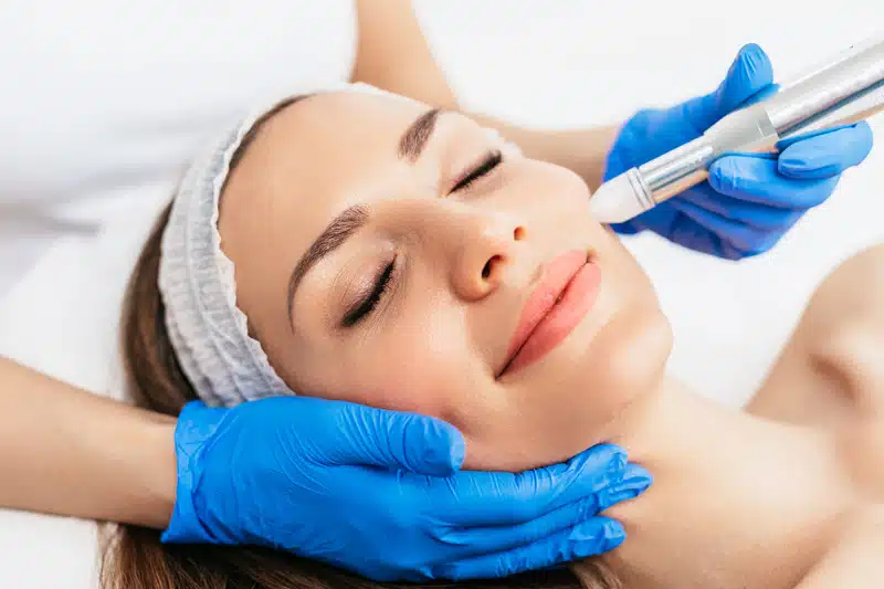 Microneedling Downtime, Healing and Results Timeline: What to Expect